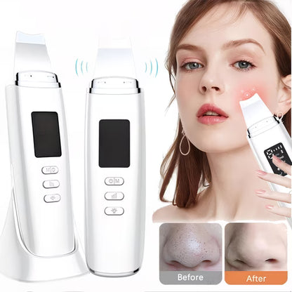 Ultrasonic üz təmizləyici